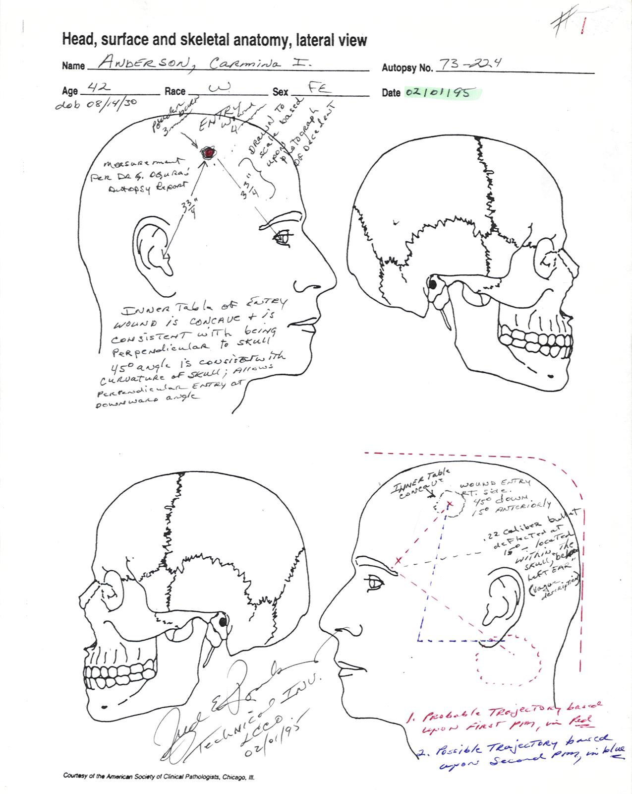 Bullet Path 1995 - in the case of the homicide of Carmina Anderson